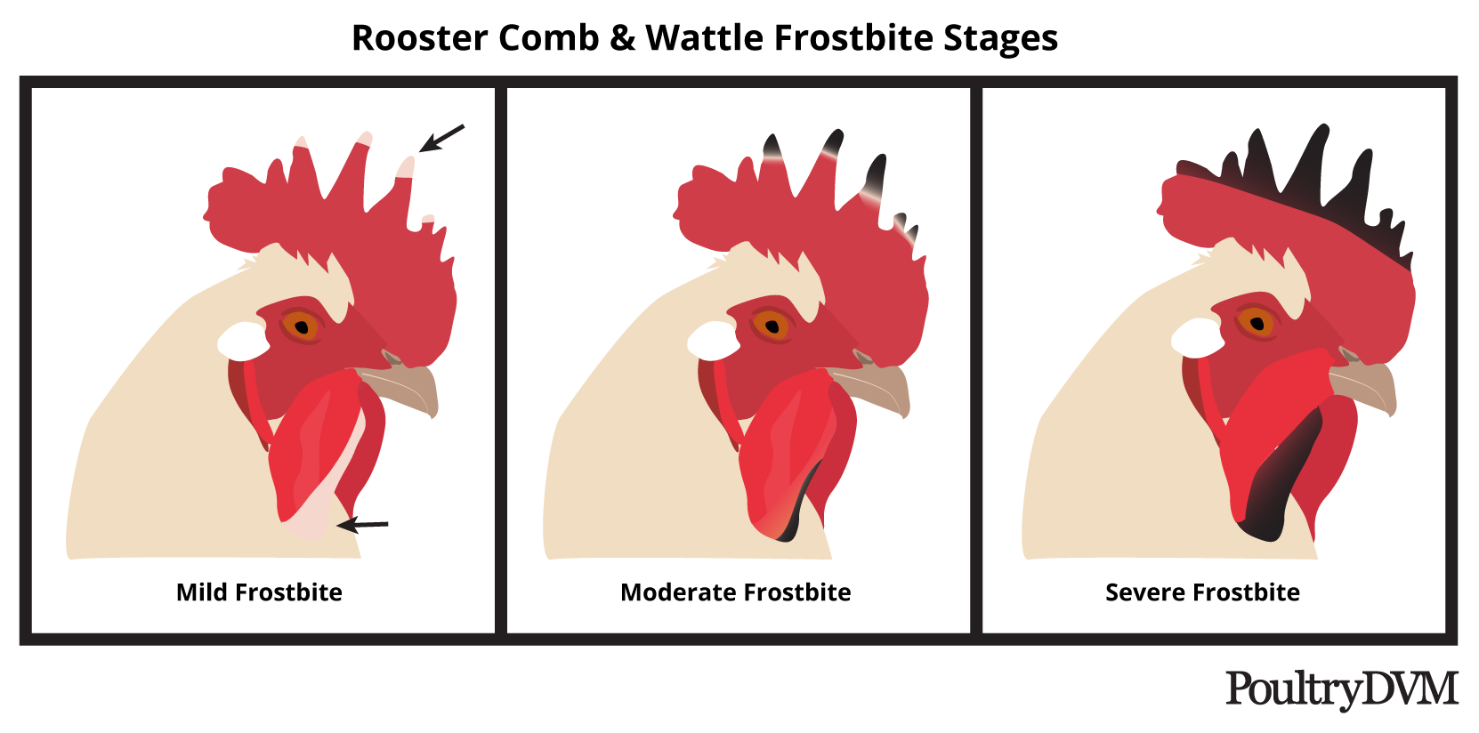 Frostbite Stages in the Chicken Comb